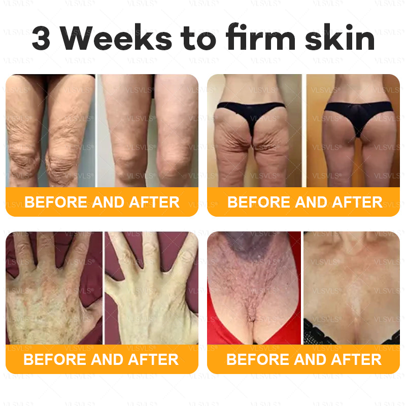 🗽🌟🗽Made and Shipped from Canada ✨ VLSVLS® Bee Venom Skin Restoration Cream 🔥 LAST DAY 80% OFF (Copy)