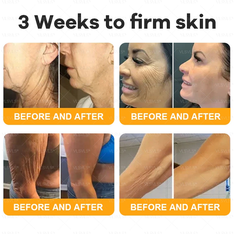 🗽🌟🗽Made and Shipped from Canada ✨ VLSVLS® Bee Venom Skin Restoration Cream 🔥 LAST DAY 80% OFF (Copy)