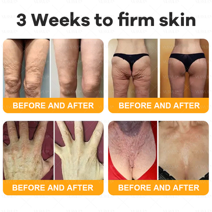 🗽🌟🗽Made and Shipped from Canada ✨ VLSVLS® Bee Venom Skin Restoration Cream 🔥 LAST DAY 80% OFF (Copy)